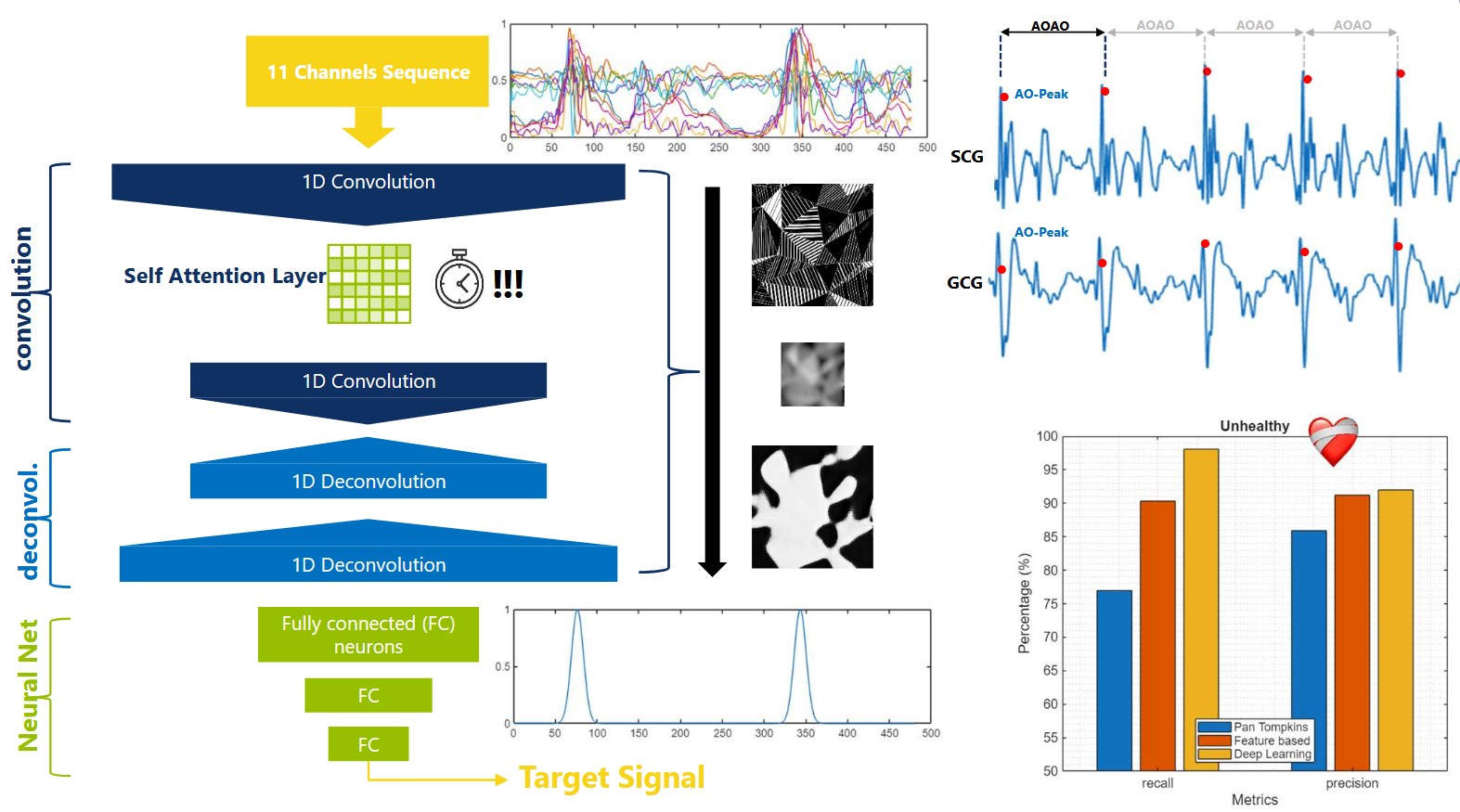 Overview 1D CNN Encoder-Decoder Architecture with Self Attention; examples of SeismoCardioGrams and GyroCardioGrams; Evaluation Results of pathological MechanoCardioGrams